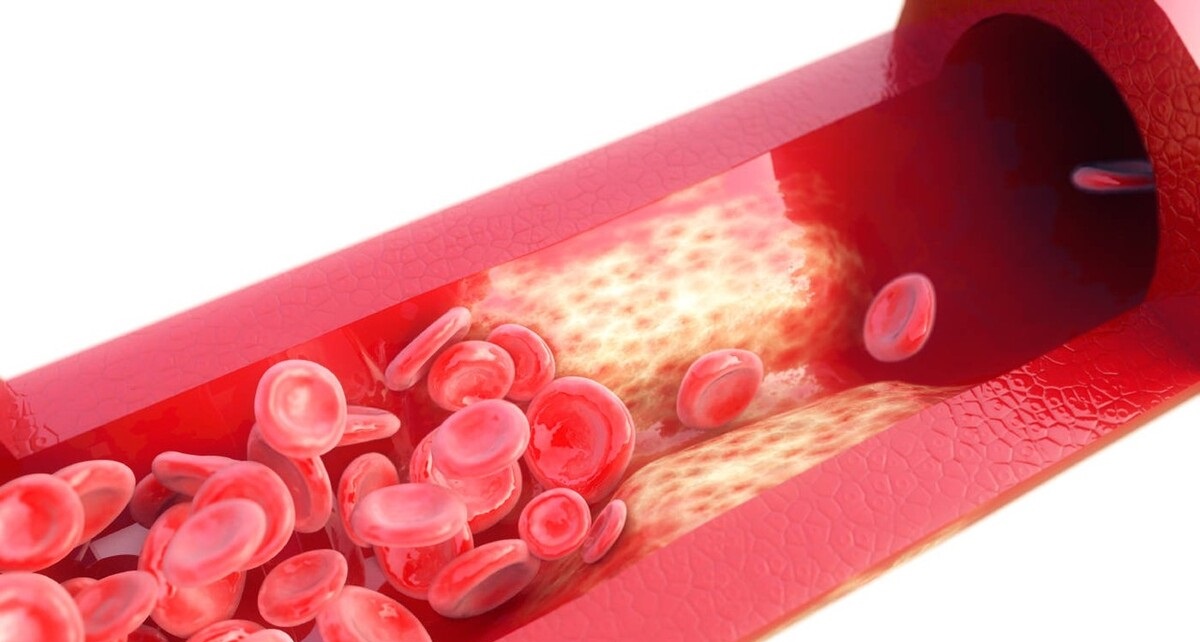 有益于血管健康的维生素k是哪种,维生素k守护血液与骨骼健康