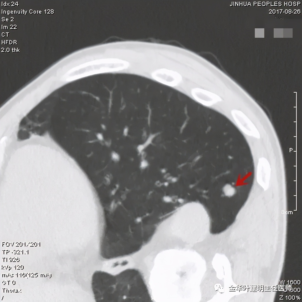 误诊报告图片,误诊案例及案例分析