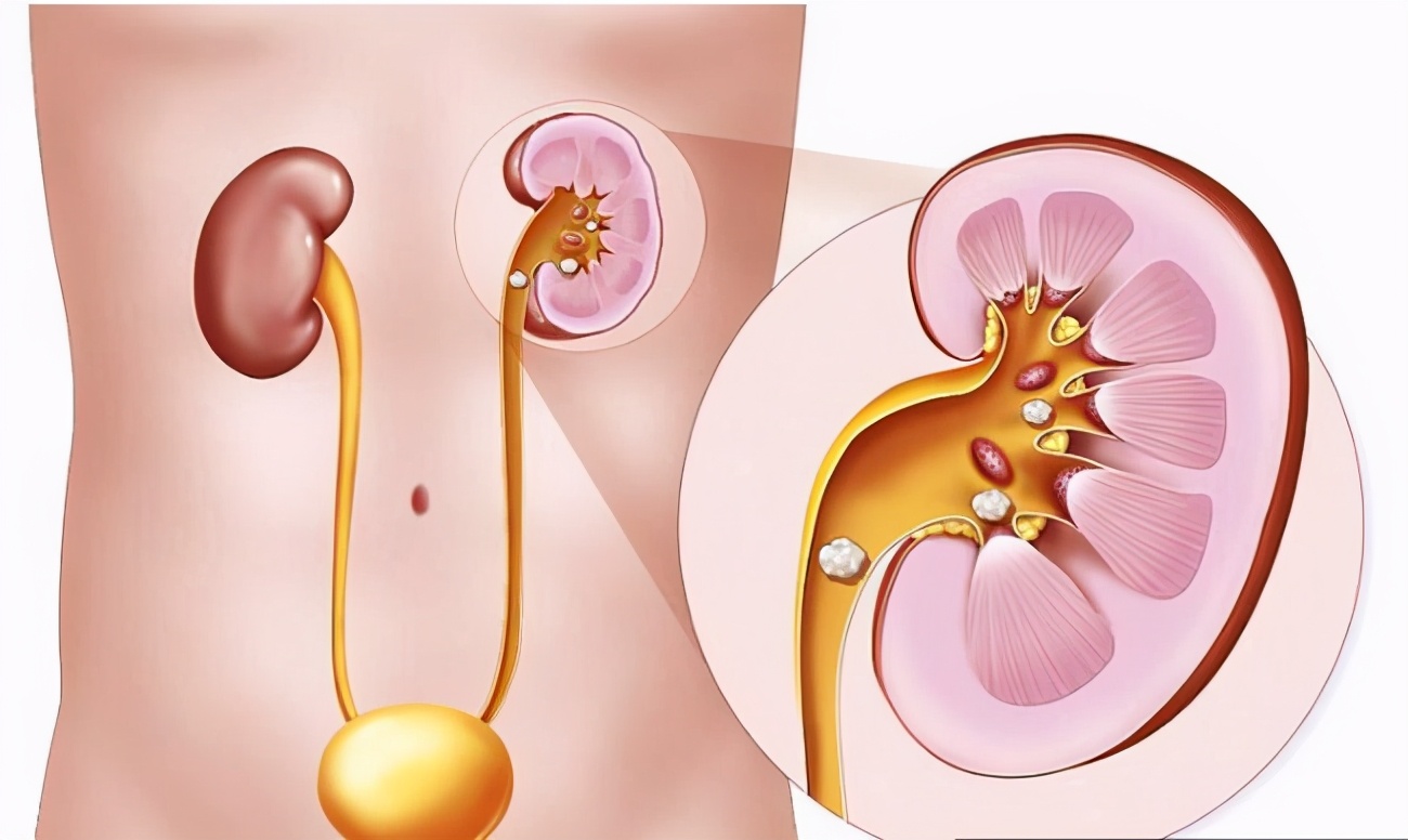 三鹿奶粉三聚氰胺事件什么时候,三聚氰胺三鹿毒奶粉事件