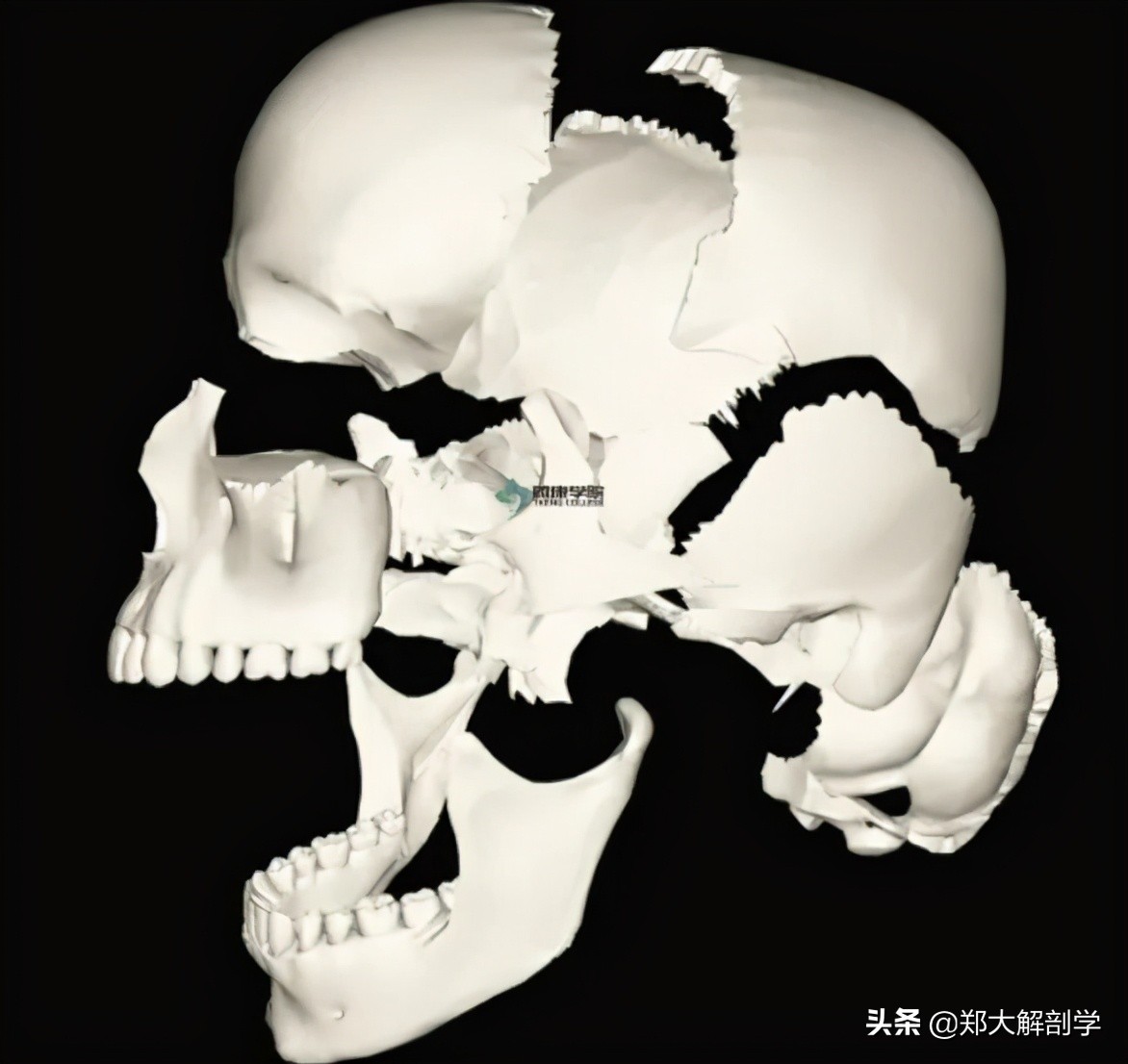 偏头痛怎么用手法缓解,偏头痛的手法治疗