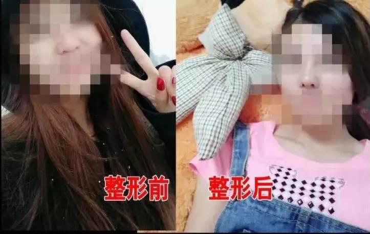 美容院整容鼻子歪,整形医院鼻子做歪了怎么办