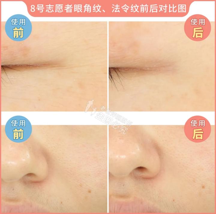 300块的网红美容仪有效果吗,网红家用美容仪测评