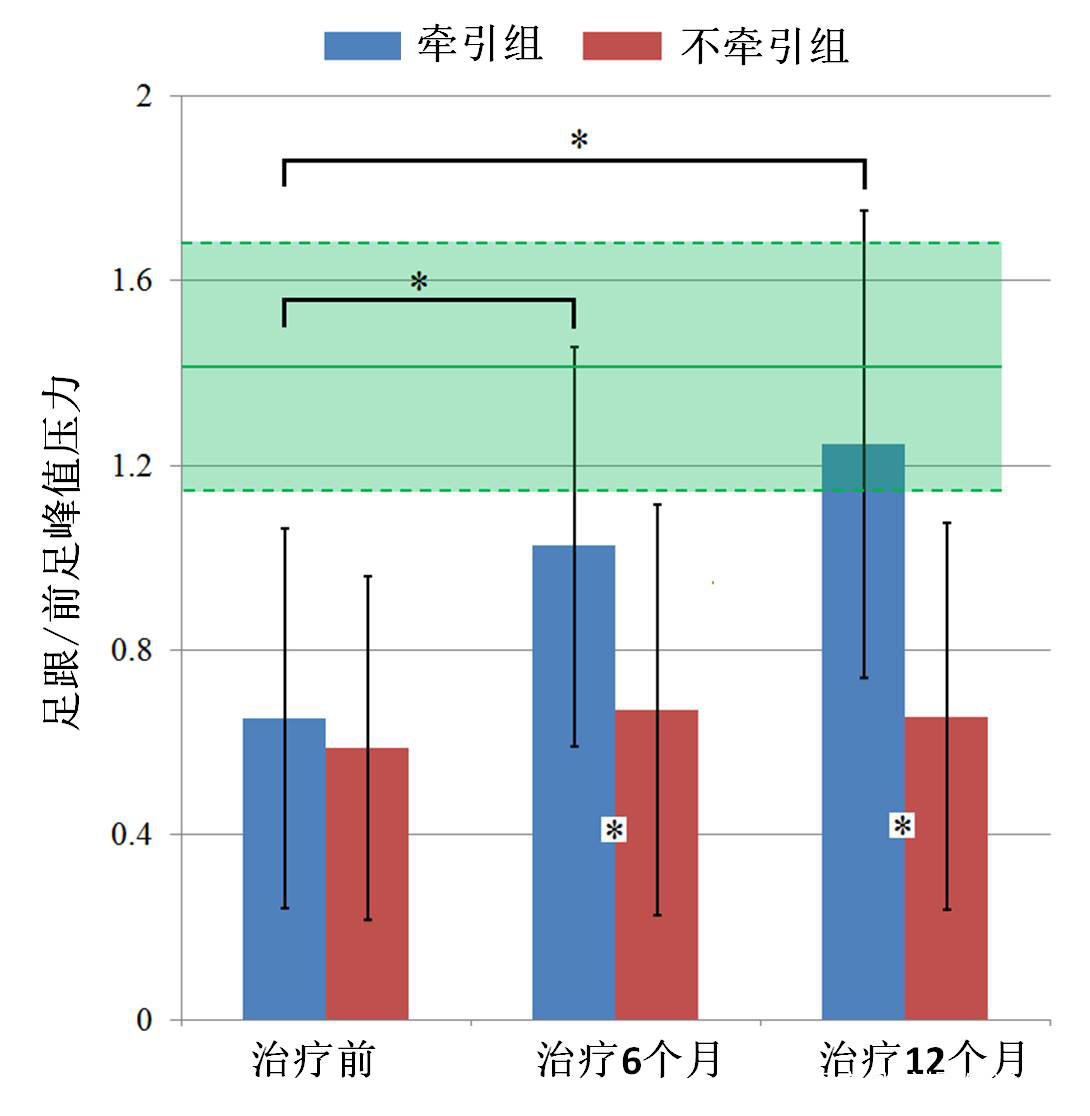 孩子足外翻买什么鞋矫正,儿童足外翻矫正鞋去哪里做