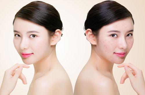 怎么解救鸡皮肤病人视频,拯救鸡皮肤