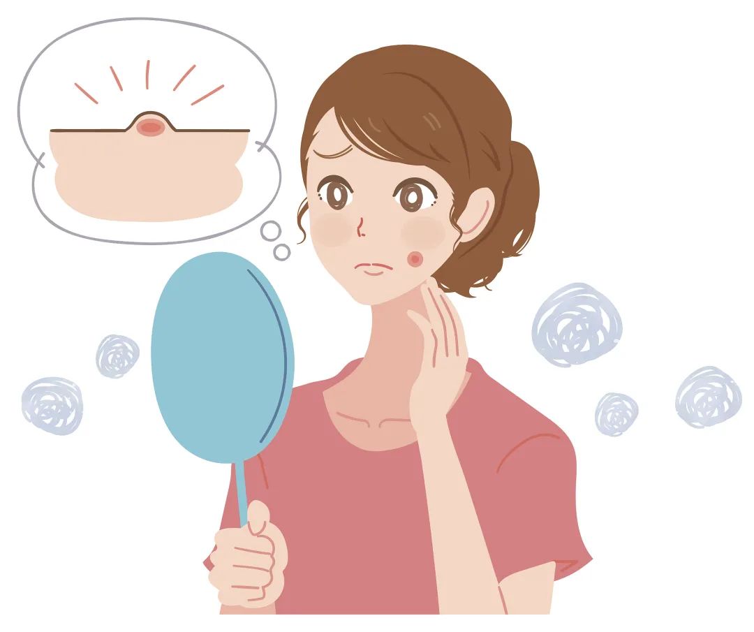 正确有效的祛除痘痘痘印方法,怎样才能彻底根治痘痘痘印