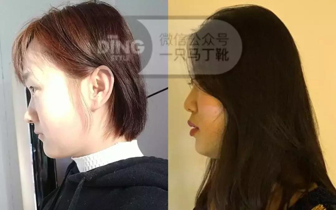 扁头怎么让头变得饱满些,扁头怎么办最快最有效