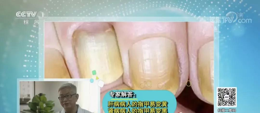 快低头看看你的手指属于什么样的,看一看你的手指是哪个类型的