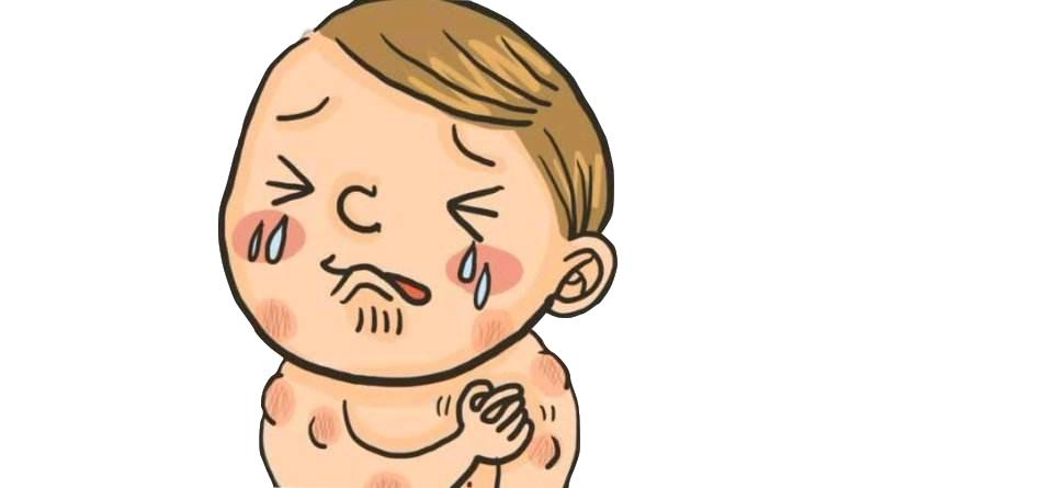 为什么得了荨麻疹的地方会有红斑,为啥得了荨麻疹好些的地方也会痒