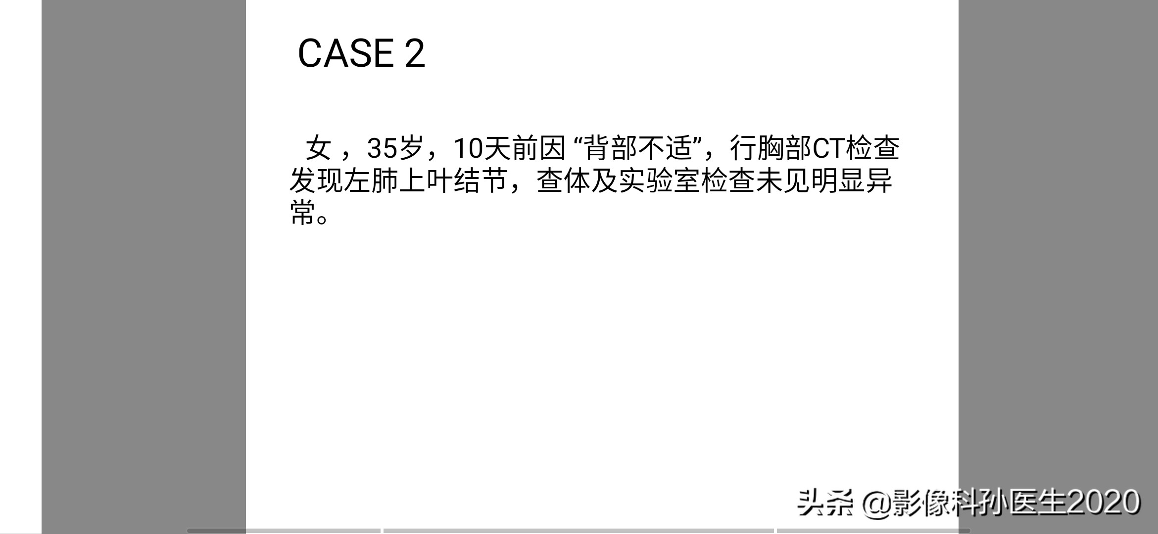 肌纤维母细胞瘤扩切能切干净吗,肌纤维母细胞瘤最好的治疗方法
