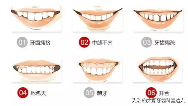 30岁整牙齿矫正多少钱,30岁还能牙齿矫正吗