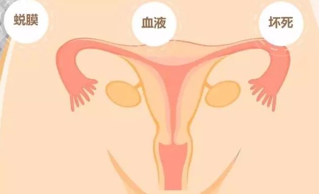 产后恶露多久排干净？最全的子宫护理方法在这里！