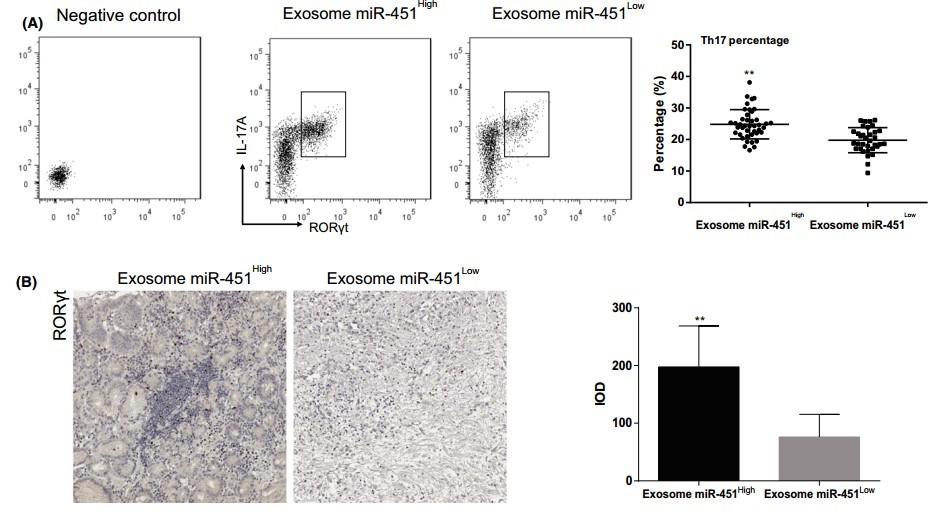 解放军359医院学者发现miR-451可以作为胃癌预后不良的指标