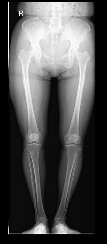 膝关节阶梯治疗ppt,膝关节骨性关节炎阶梯化治疗