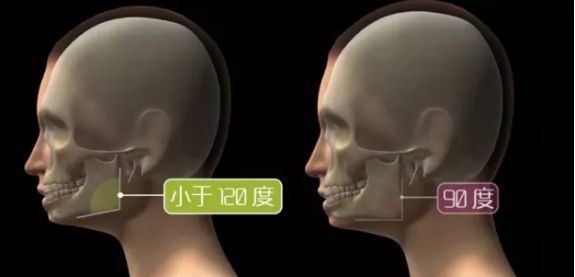 娣卞湷棰岄潰澶栫鏁村舰,娣卞湷鍙ｈ厰鍖婚櫌棰岄潰鏁村舰