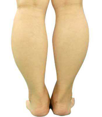 女生的腿哪样才算是最标准,女性腿粗的原因有哪些