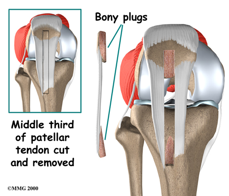 跑步爬楼梯膝盖疼休息就好,跑步爬楼梯导致膝盖疼还能运动吗