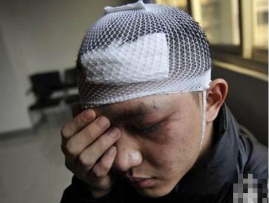 面试官：后脑勺受伤的人怎样睡觉？小伙秒答之后，无情被淘汰