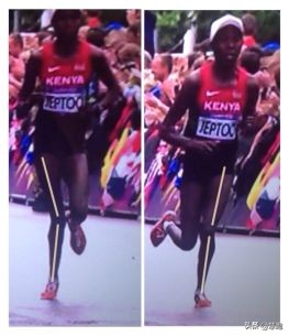 美国膝关节炎是怎么治疗的,美国膝关节炎治疗系统