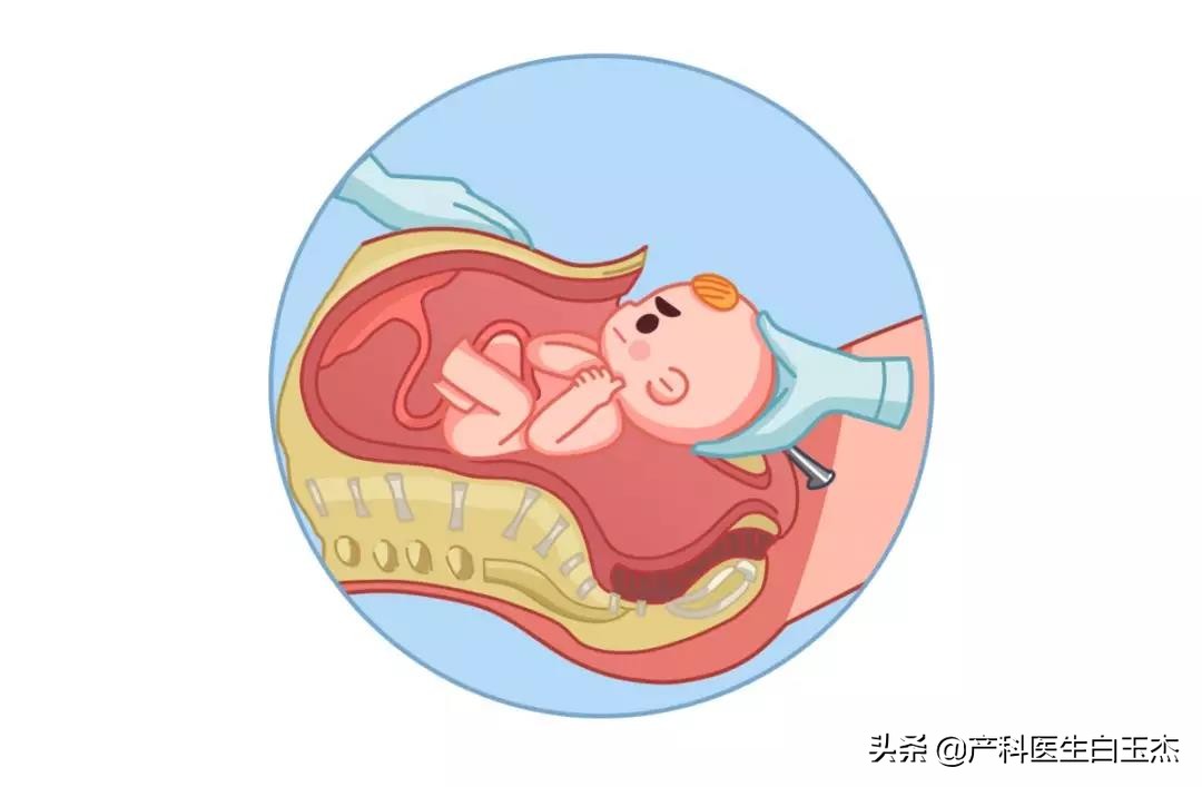 产后恶露的正确观察方法,恶露是什么颜色说明已经排干净了