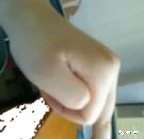 胎儿心脏三种血管关系模式图,25周的胎儿心脏弓切面多少正常