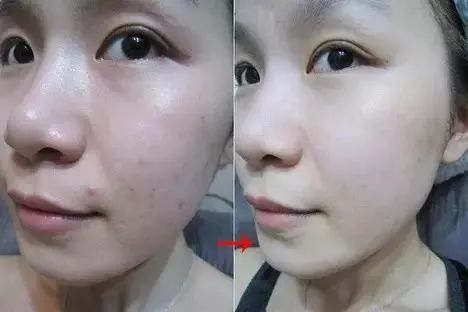 好用的蓝铜肽精华,蓝铜肽精华液抗老