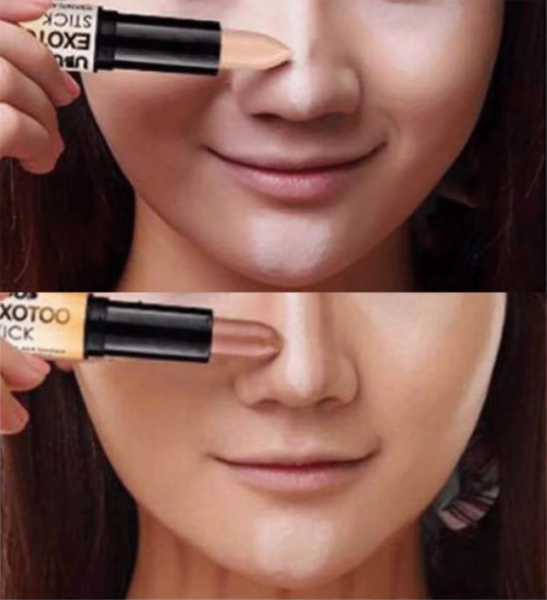 花10万打玻尿酸经验总结,花了将近十万打玻尿酸没有效果