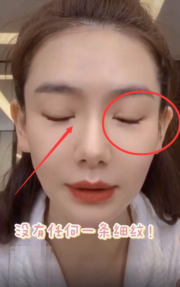 戚薇35岁照,戚薇眼部细纹