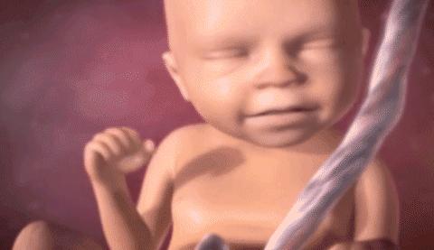 四维彩超和系统性超声的区别,四维彩超比普通b超准确吗