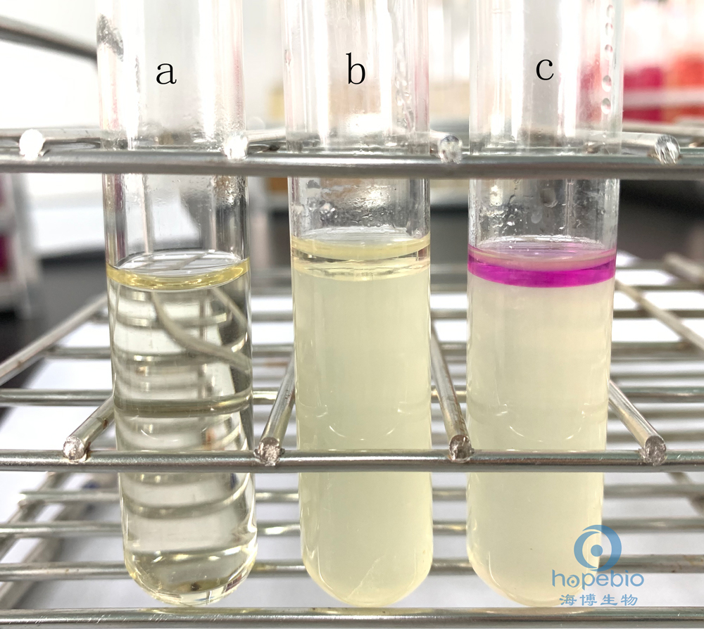 普通变形杆菌有哪些,为什么奇异变形杆菌那么难治