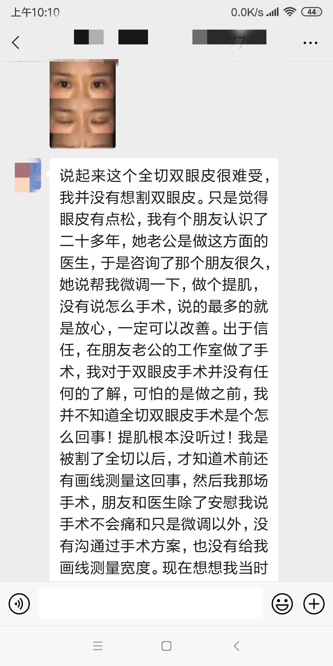 上海马大哈姑娘，稀里糊涂整了容，术后就一个字：丑