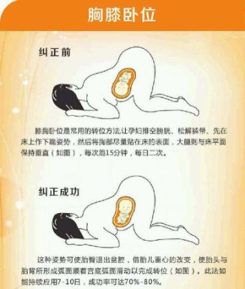 b超单上胎位怎么看,b超单怎么看胎位正确