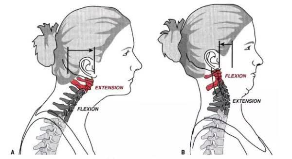 坐着直背训练纠正驼背,一个动作纠正驼背快速锻炼方法
