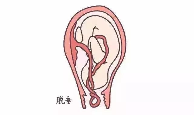 产检正常为啥小孩出生后还有毛病,产检正常却生下异常宝宝