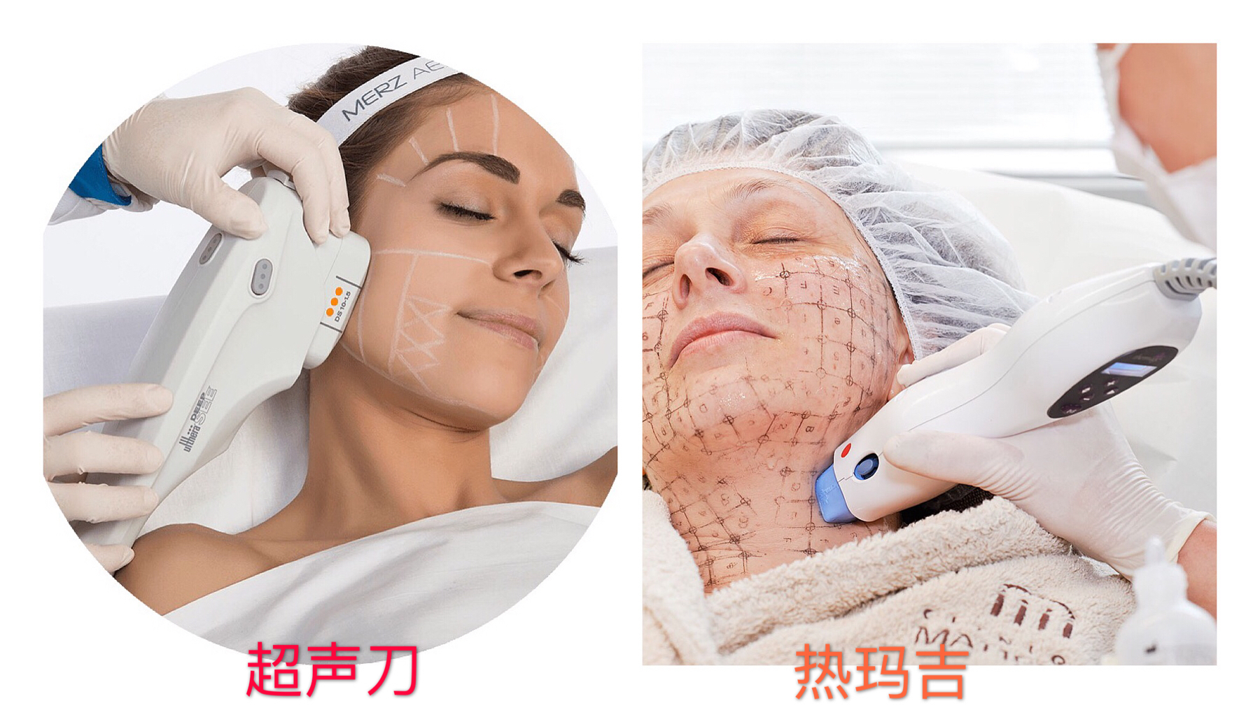 超声刀热玛吉都是什么仪器,医美小课堂热玛吉和超声刀区别
