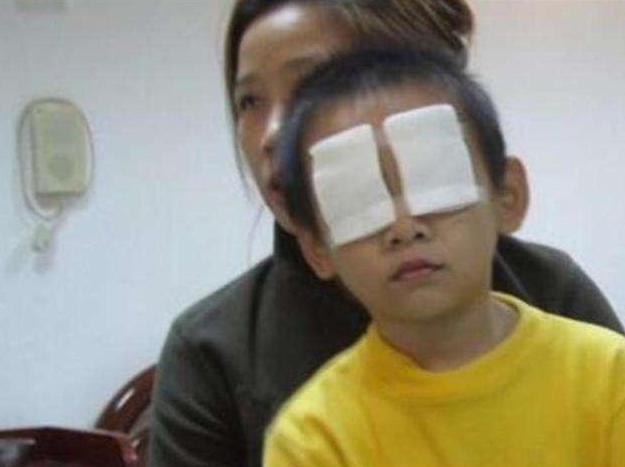 小孩石灰进眼睛,小孩眼睛迷了东西
