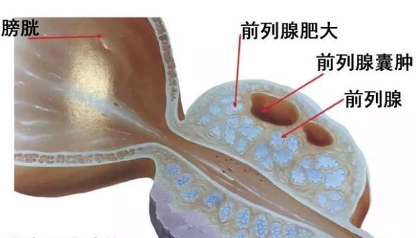 雄性犬为“良性前列腺增生症”风险种群，又该如何治疗和预防？