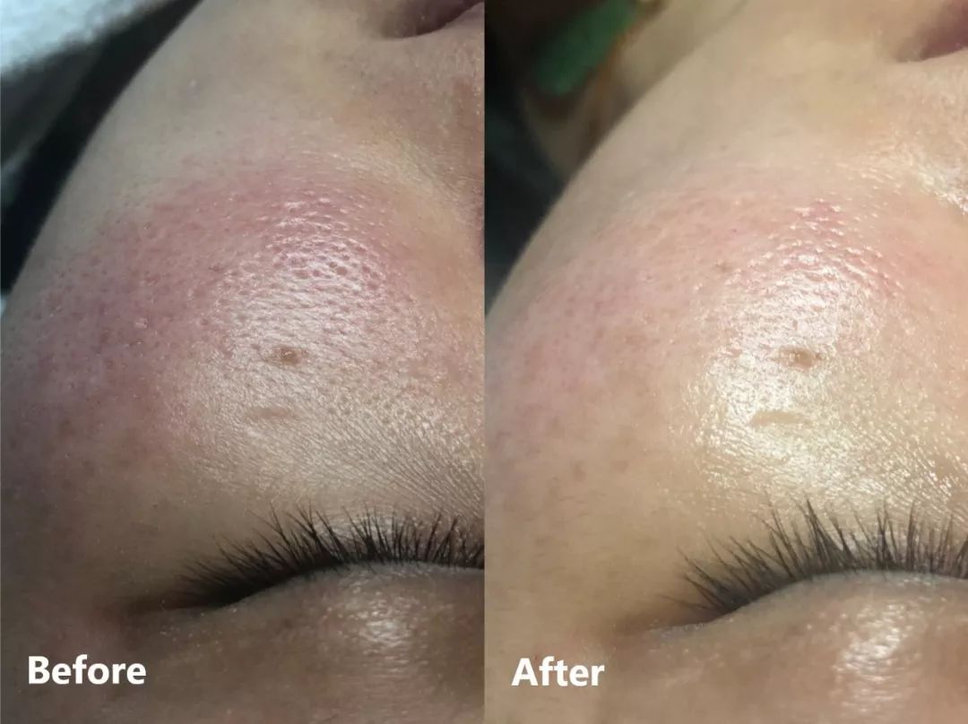 每周一次精准有效的皮肤管理,选对护肤方法让你做靓丽女神