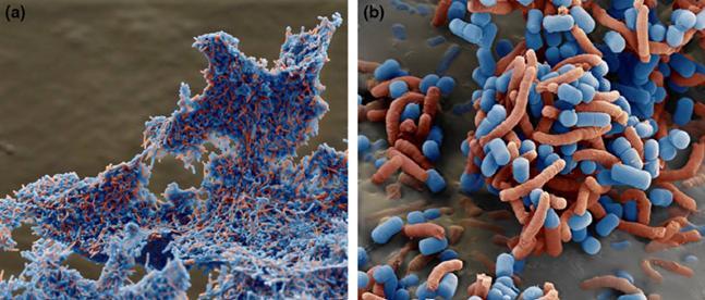 幽门螺旋菌：除了4联疗法，还有什么选择