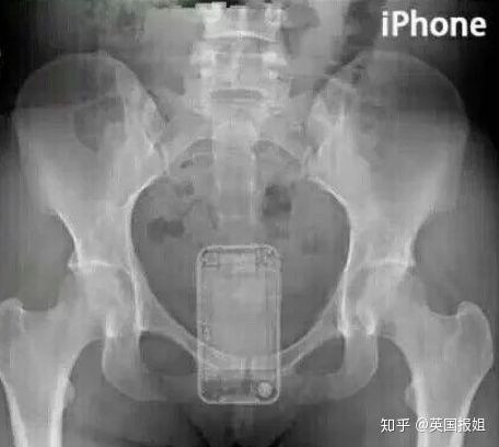 用命换钱的“骡子,是如何把大量*品毒**塞进自己体内的?