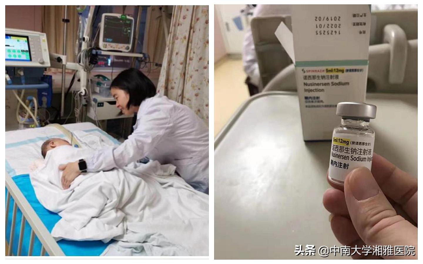 脊髓性肌萎缩症特效药是谁研发的,治疗脊髓性肌萎缩症需要打几针