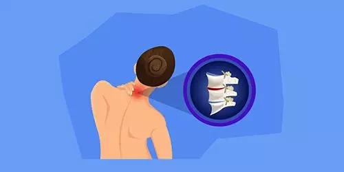 脖子酸痛扭脖子咔咔响,扭脖子咔咔响对颈椎有坏处吗