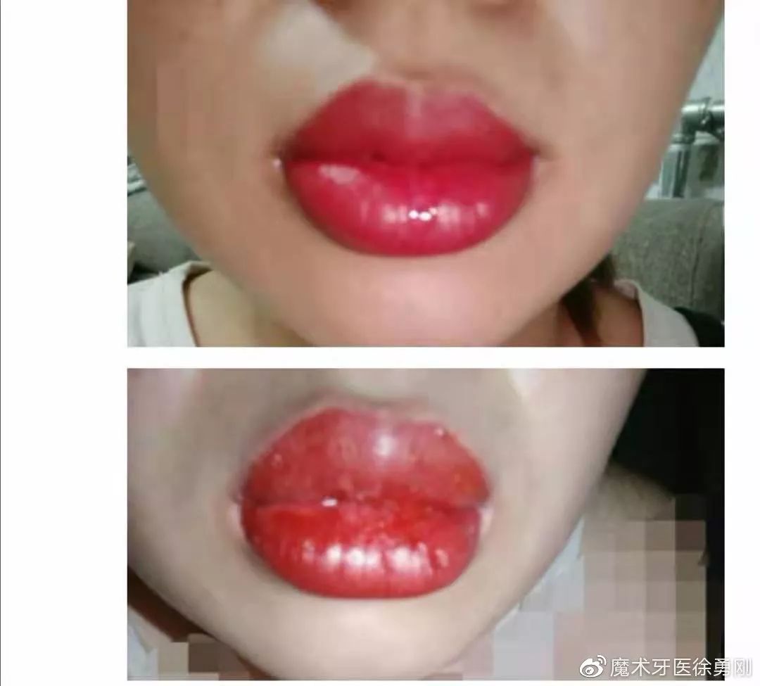 内行人为什么不建议漂唇,作为一名医生一直被人质疑