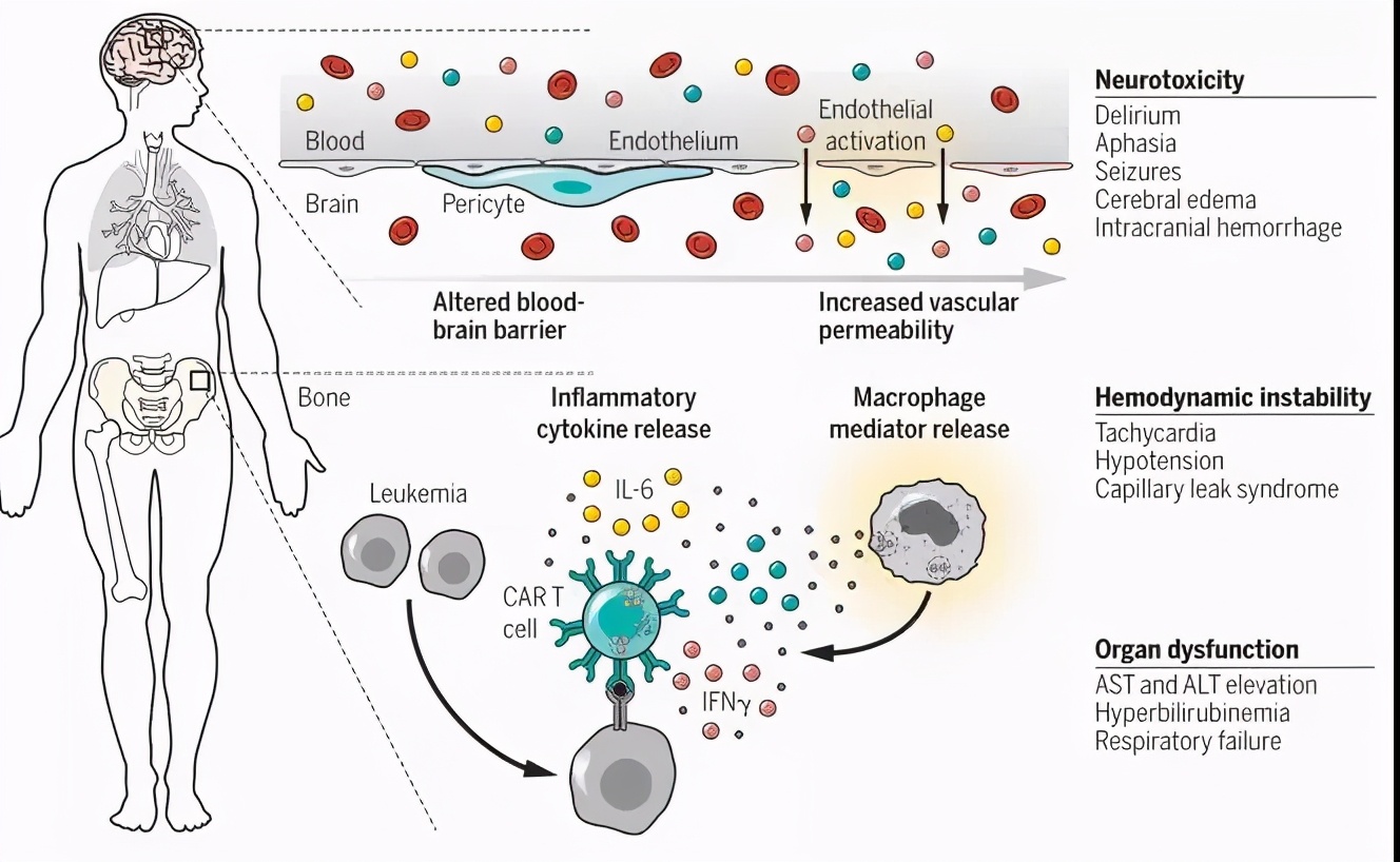 car-t细胞免疫疗法前景如何,car-t细胞免疫疗法临床试验招募