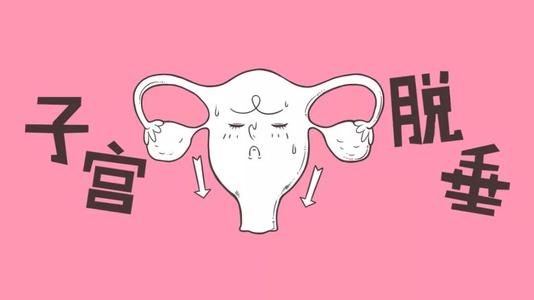 子宫脱垂产后一年还能治疗,产后子宫脱垂怎么治疗最好