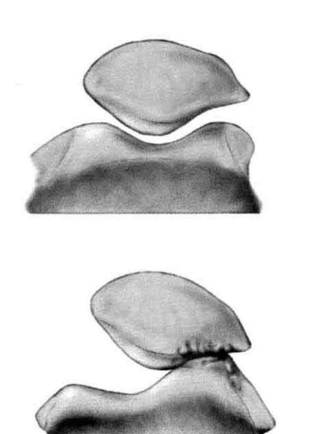 爬楼梯膝盖骨关节疼怎么办,爬楼梯爬到膝盖疼怎么办