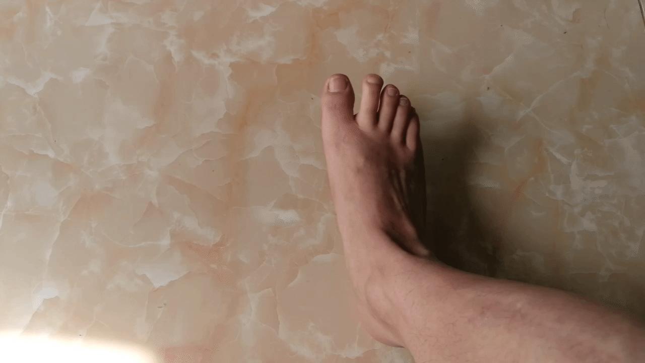 如何治疗足底筋膜炎缓解疼痛,足跟痛筋膜炎最佳的治疗办法