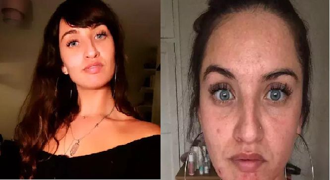 警惕家中霉菌引发肺部真菌感染,怎么防止家里霉菌