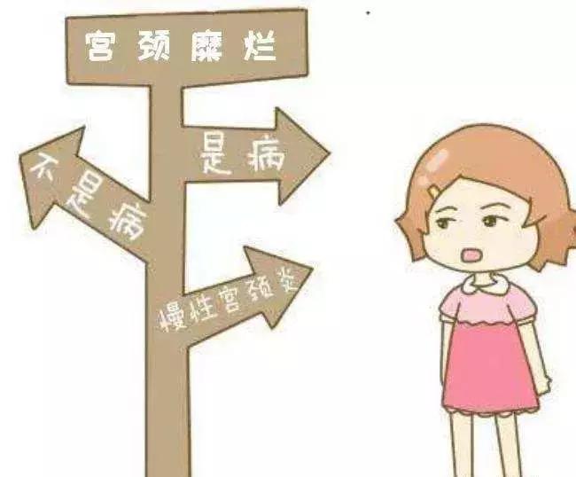 了解宫颈癌的科普,了解细菌阴道炎