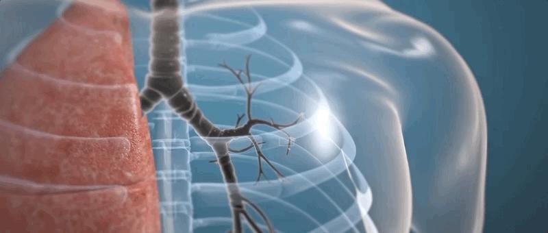 哮喘的发病原理,哮喘科普文章作品简介