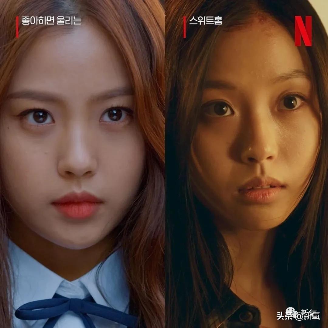 阔面脸轮廓怎么做,阔面脸怎么做医美